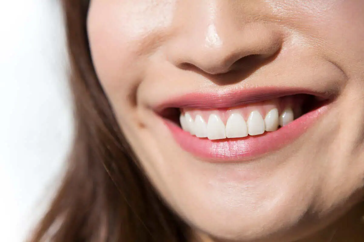 A woman is receiving dental treatments at Peninsula Center of Cosmetic Dentistry