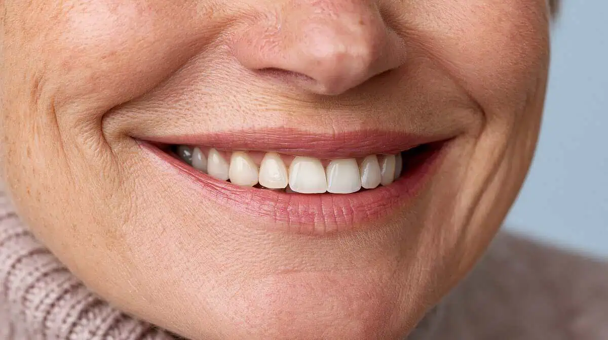 Snap-On Smile in Los Altos, CA and Lehi, UT at Peninsula Center of Cosmetic Dentistry